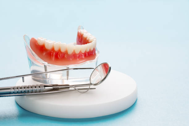 Best Veneers and Lumineers  in Saks, AL